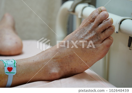 長照 長照 102648439