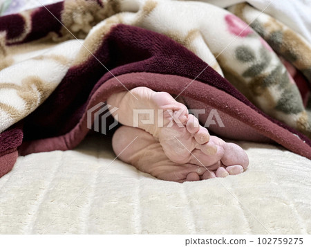 Soles of elderly women's feet 102759275