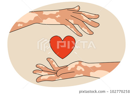 Person with leprosy hold heart 102770258