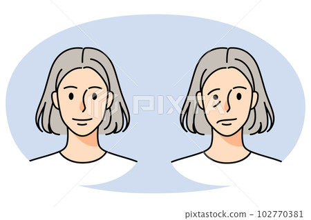 Old woman struggle with facial nerve palsy 102770381