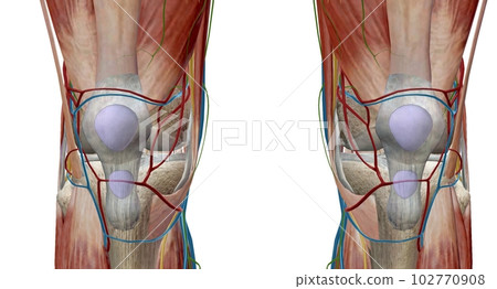 The knee is the largest and most complex joint in the body that holds the thighbone, shinbone, and kneecap together. 102770908