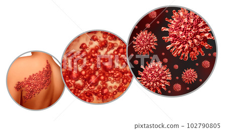 Shingles Virus 102790805