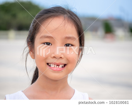 close up shot of face asian child cute or kid girl smiling eyes white teeth and one broken tooth or drop from baby or milk tooth on 7 years old close up shot of face asian child cute or kid girl smiling eyes white teeth and one broken tooth or drop from baby or milk tooth on 7 years old 102810081