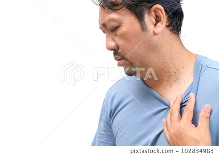 middle age senior man with skin tags or acrochordon on his neck isolated on white middle age senior man with skin tags or acrochordon on his neck isolated on white 102834983