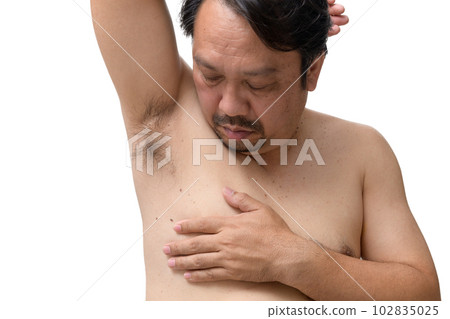 Close up the skin tags on man's skin under the armpits and sides of the body isolated on white Close up the skin tags on man's skin under the armpits and sides of the body isolated on white 102835025
