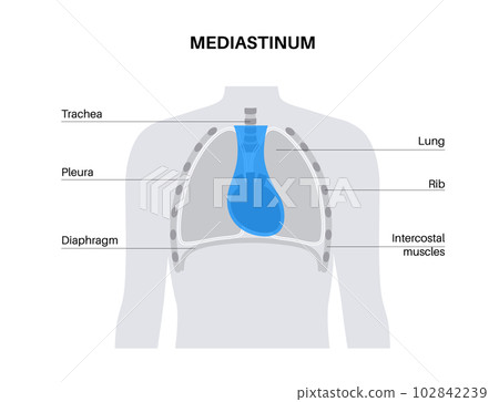 Mediastinum infographic poster Mediastinum infographic poster 102842239