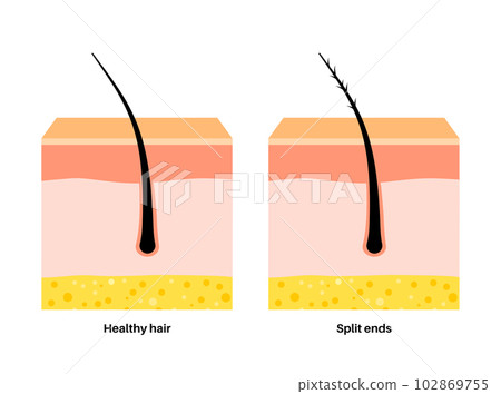 Split and normal hair 102869755
