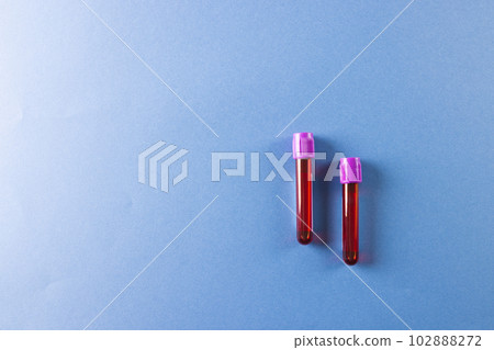 Two blood sample tubes with purple lids, on blue background with copy space Two blood sample tubes with purple lids, on blue background with copy space 102888272