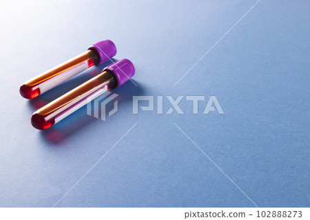 Two blood sample tubes with purple lids, on blue background with copy space Two blood sample tubes with purple lids, on blue background with copy space 102888273
