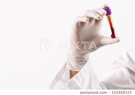 Hand in white surgical glove holding blood sample tube, on white background with copy space Hand in white surgical glove holding blood sample tube, on white background with copy space 102888325