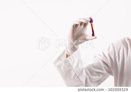 Hand in white surgical glove holding blood sample tube, on white background with copy space Hand in white surgical glove holding blood sample tube, on white background with copy space 102888329