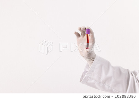 Hand in white surgical glove holding blood sample tube, on white background with copy space Hand in white surgical glove holding blood sample tube, on white background with copy space 102888386