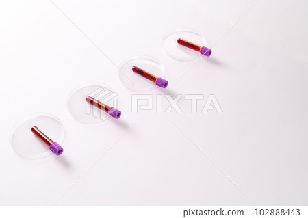 Row of blood sample tubes in petri dishes, on white background Row of blood sample tubes in petri dishes, on white background 102888443
