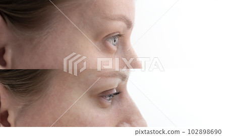 Before And After Eyelashes Lamination Of Caucasian Beautiful Young Woman, Closeup. Profile Side. Horizontal Plane 102898690