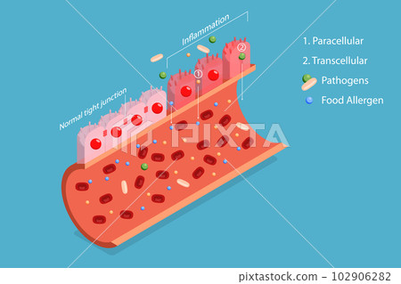 3D Isometric Flat Vector Conceptual Illustration of Leaky Gut Syndrome 3D Isometric Flat Vector Conceptual Illustration of Leaky Gut Syndrome 102906282