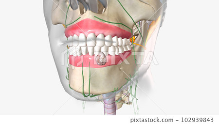 Oral cancer is an uncontrollable growth of cells that begins anywhere in the mouth. 102939843
