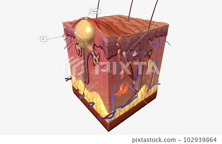 Acne Papule Papule is a type of acne characterized by a large, inflamed bump on the skin. Acne Papule Papule is a type of acne characterized by a large, inflamed bump on the skin. 102939864