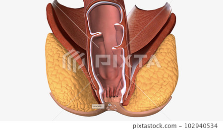 Anal warts are painless, growths along the skin near the anal canal. Most anal warts are caused by human papillomavirus (HPV). 102940534