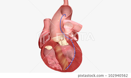 Alcohol causes enlarged heart muscle walls to shrink Alcohol causes enlarged heart muscle walls to shrink 102940562