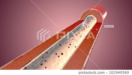 A healthy artery has supple and muscular walls that help blood flow. 102940569