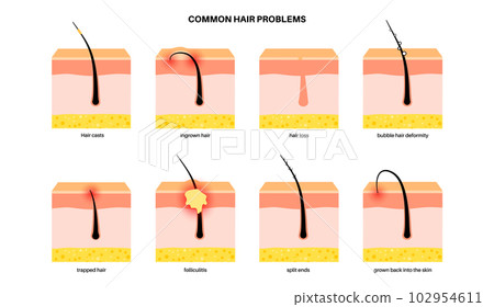 Common hair problems 102954611