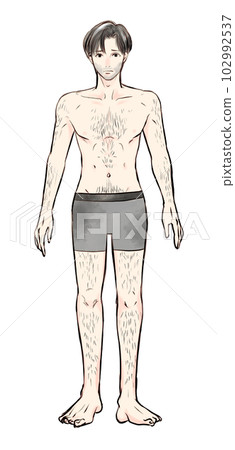 Full body illustration of a man suffering from unwanted hair 102992537