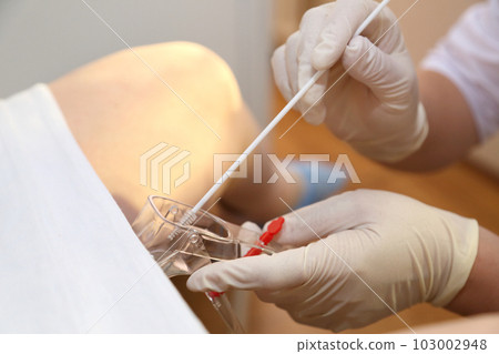 The gynecologist takes a vaginal swab for bacterial examination. Gynecological chair. A woman at the gynecologist for a check-up. The gynecologist takes a vaginal swab for bacterial examination. Gynecological chair. A woman at the gynecologist for a check-up. 103002948
