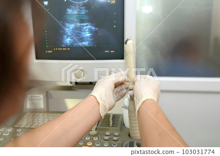 Vaginal ultrasound examination. A woman at the gynecologist for a check-up. Vaginal ultrasound examination. A woman at the gynecologist for a check-up. 103031774