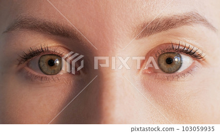 Eye care. Vision correction. Laser surgery. Optometry ophthalmology. Closeup woman face staring with confident sight look visual acuity health treatment. Eye care. Vision correction. Laser surgery. Optometry ophthalmology. Closeup woman face staring with confident sight look visual acuity health treatment. 103059935