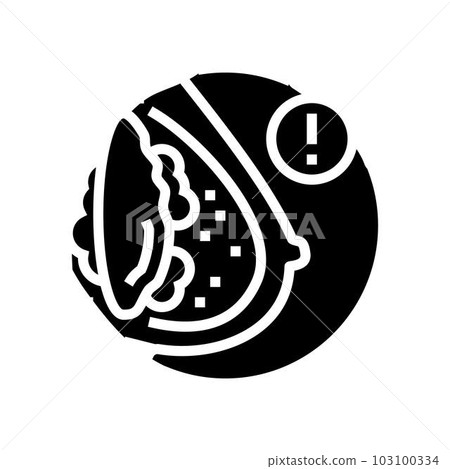 capsular contracture surgery glyph icon vector illustration capsular contracture surgery glyph icon vector illustration 103100334