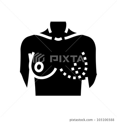 breast reconstruction surgery glyph icon vector illustration breast reconstruction surgery glyph icon vector illustration 103100388