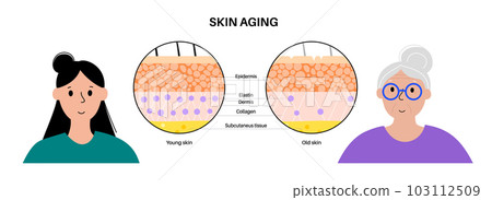 Skin aging poster 103112509
