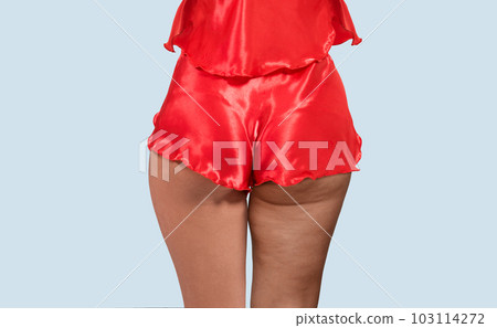 Woman's thighs and buttocks with cellulite. 103114272