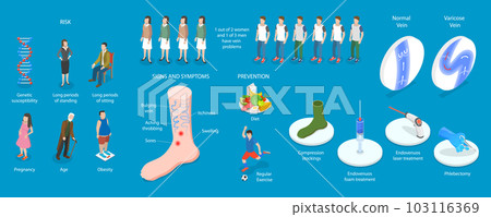 3D Isometric Flat Vector Conceptual Illustration of Varicose Veins 3D Isometric Flat Vector Conceptual Illustration of Varicose Veins 103116369