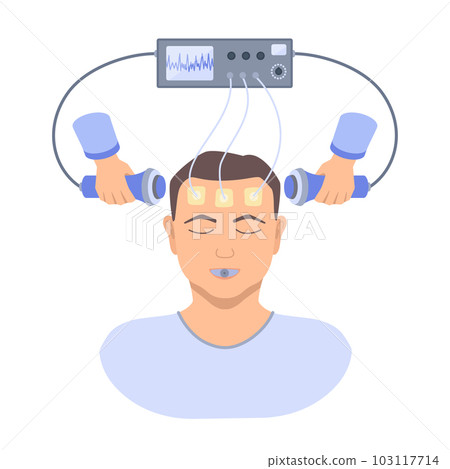 ECT electroconvulsive therapy for severe depression treatment 103117714