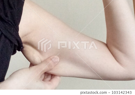 鬆弛在下臂 鬆弛在下臂 103142343
