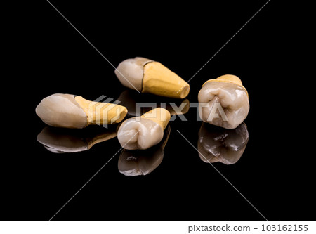 Prosthetic teeth 103162155