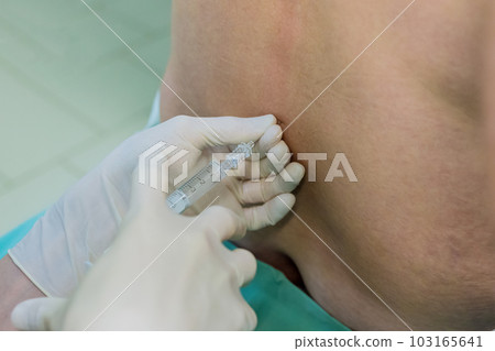 Surgical room lumbar spinal puncture procedures for collecting samples in patient 103165641