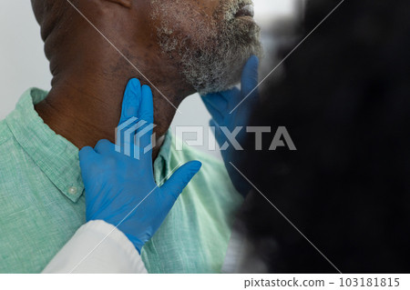 Biracial female doctor wearing medical gloves examinating african american male patient 103181815