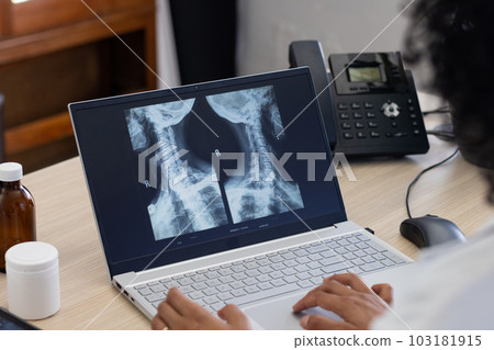 Biracial female doctor using laptop with radiograph on screen at doctor's office 103181915