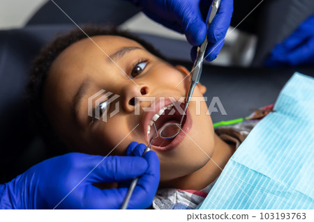 Dentist treating dark-skinned boys teeth Dentist treating dark-skinned boys teeth 103193763
