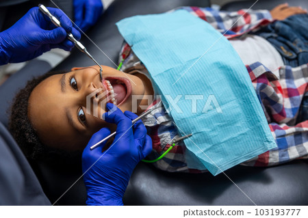 African-american boy teeth treatment close up African-american boy teeth treatment close up 103193777