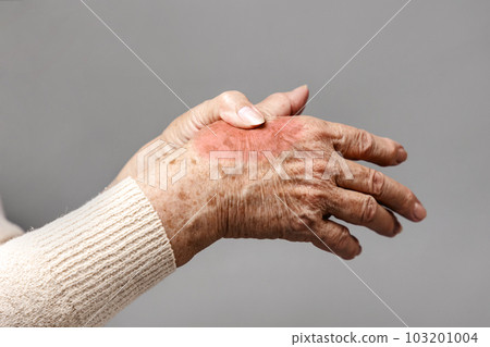 A senior woman is doing a brush massage, experiencing pain. Gray background, hands close-up. The concept of rheumatism and arthritis 103201004