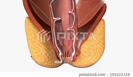 Anal warts are painless, growths along the skin near the anal canal. Most anal warts are caused by human papillomavirus (HPV). 103222128