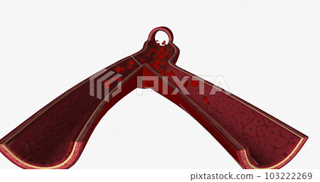 The vascular system is the body's network of blood vessels. 103222269