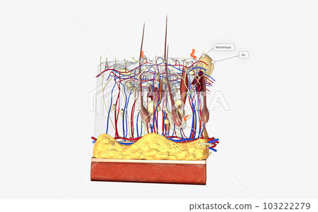 Closed comedones (whiteheads) are a type of acne characterized by small pink bumps with white, pus-filled centers. Closed comedones (whiteheads) are a type of acne characterized by small pink bumps with white, pus-filled centers. 103222279