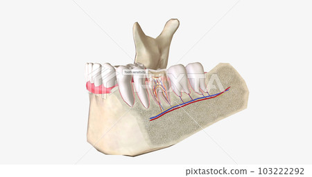 Sensitive teeth is a common dental condition characterized by sharp tooth pain. 103222292