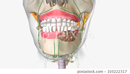 Once a tumor has spread into nearby lymph nodes, it is considered a stage three cancer. 103222317