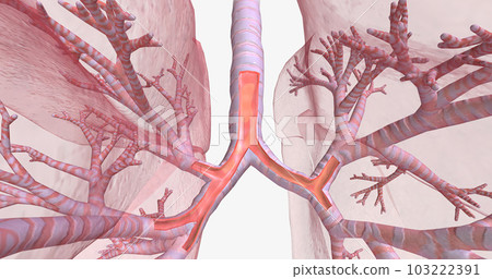 Inflammation and constriction of airways 103222391