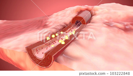 Artery dilates due to increase of ARBs in the blood 103222848